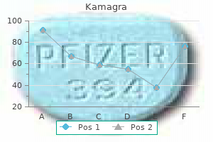 buy kamagra overnight delivery