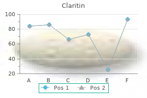 claritin 10 mg buy free shipping