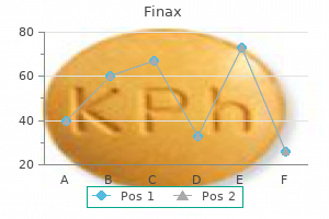 generic finax 1 mg with mastercard