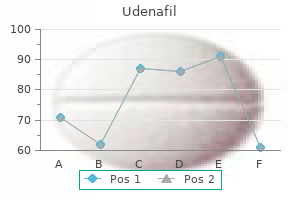 cheap 100 mg udenafil with mastercard