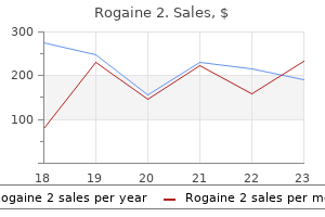 generic rogaine 2 60 ml on line