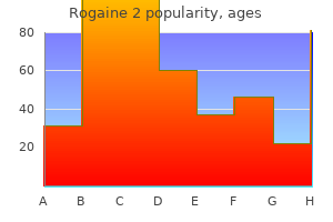 order rogaine 2 60 ml