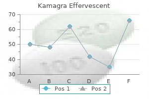 purchase kamagra effervescent on line amex