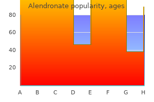 order alendronate 70 mg on line