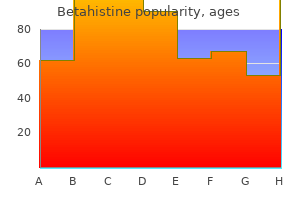 order 16mg betahistine amex