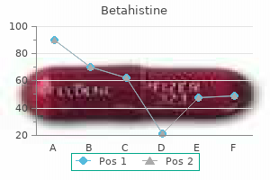 discount betahistine 16 mg online