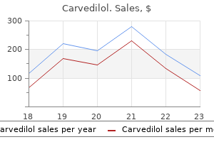 generic carvedilol 25 mg buy on line