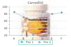 generic carvedilol 25 mg overnight delivery