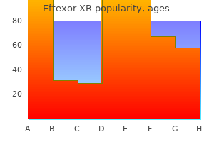 generic effexor xr 75 mg buy on-line