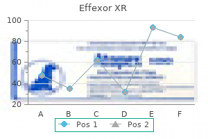 purchase 75 mg effexor xr fast delivery