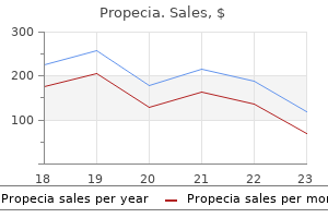 buy propecia 5 mg visa