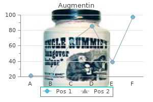 best augmentin 375 mg