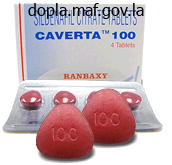 cheap caverta 50 mg fast delivery