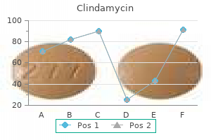 order 150 mg clindamycin amex